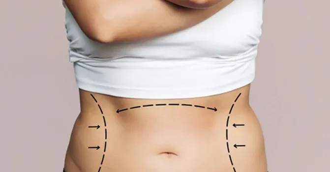 How to Choose the Right Abdominal Surgery Provider for Your Needs