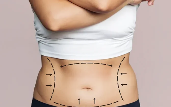 How to Choose the Right Abdominal Surgery Provider for Your Needs